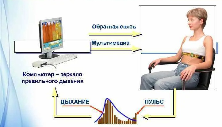 Neuroconversion